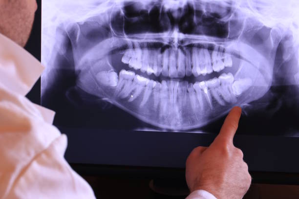Best Emergency Treatment for Oral Infections in Guadalupe, AZ