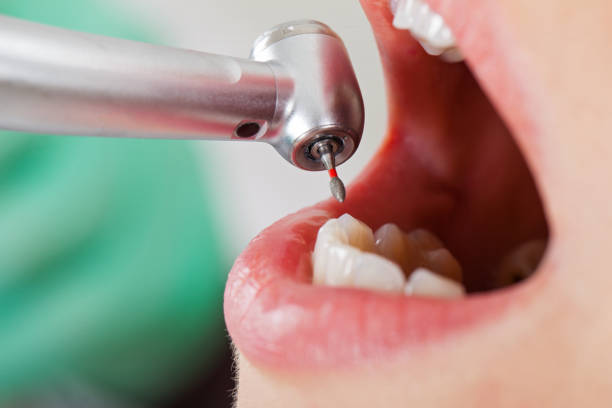 Best Broken or Chipped Tooth Repair in Guadalupe, AZ